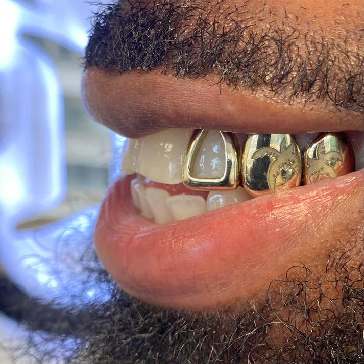 Silver Window Grillz side view