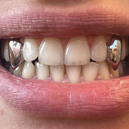 Vampire Fang Grillz close up 2